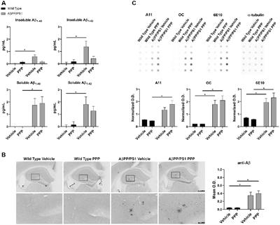 IGF-1R Inhibitor Ameliorates Neuroinflammation in an Alzheimer’s Disease Transgenic Mouse Model
